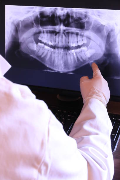 Best Emergency Dental Care for Broken or Chipped Teeth in Manti, UT